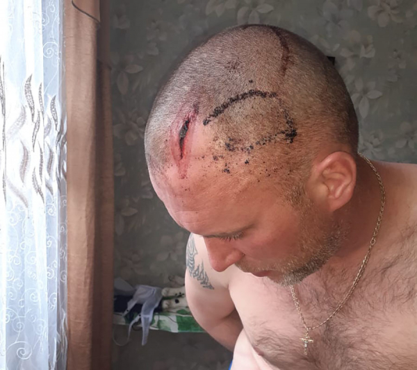 «Не видел, куда наносил удары»: защищавшего семью мужчину будут судить за тройное убийство «Не видел, куда наносил удары»: защищавшего семью мужчину будут судить за тройное убийство