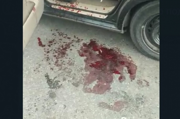 Лужи крови на асфальте: водитель седана на встречке "собрал" две иномарки в Хабаровске&nbsp;