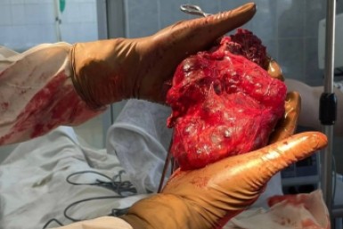 Итоги дня: боеприпас в доме, взлом аккаунтов, скрининг 36 заболеваний и семейная ОПГ