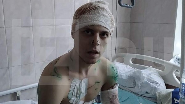 Искусанный собаками хабаровчанин рассказал о своем состоянии
